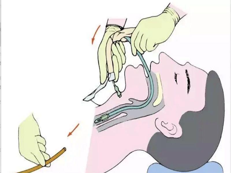 పిక్చర్-2 పిక్చర్-2